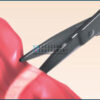 ENERTECH Vessel Sealing System - Image 4