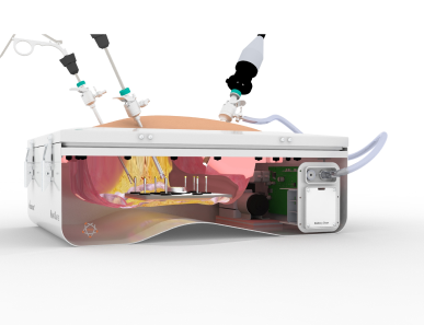 Laparoscopic bead placement training on endotrainer for surgical orientation and precision skill development