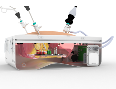 Laparoscopic peg transfer training on endotrainer for hand-eye coordination and instrument handling skills